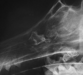 Craniomandibular Osteopathy June 2008-03