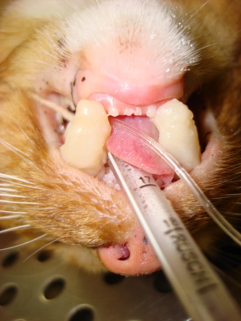 TMJ Reduction -Luxation of the left condyle 04